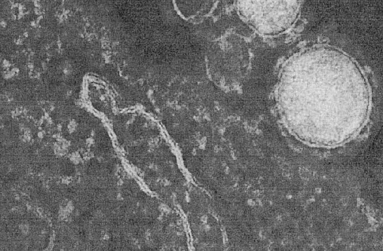Рекомендации по профилактике заболеваний, вызываемых коронавирусами